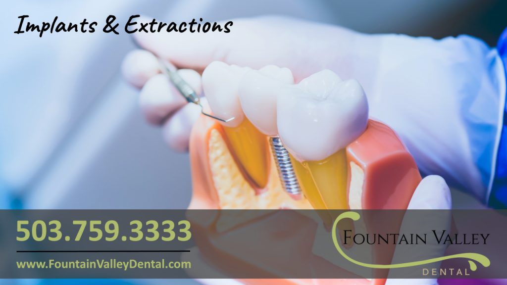 Molalla Dentist General and family dentistry in Molalla Oregon Dental Implants and Extractions