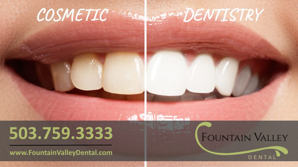 Cosmetic Dentistry Dentist in Molalla Oregon Teeth Whitening Crowns Porcelain Veneers Invisalign Braces at Fountain Valley Dental