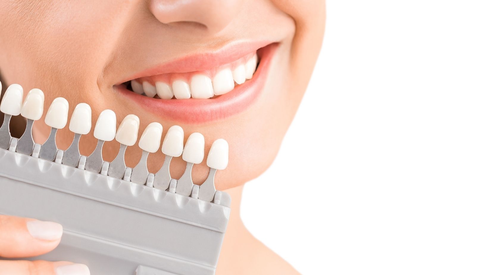 5 Things to Know About Dental Whitening 