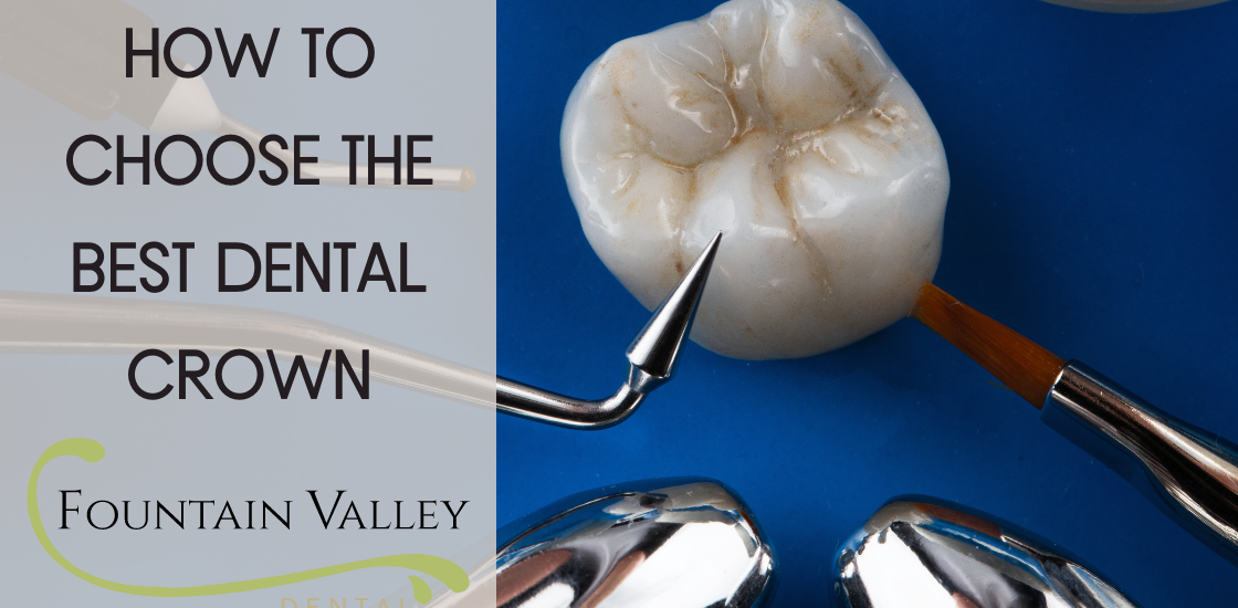 How To Choose The Best Dental Crown