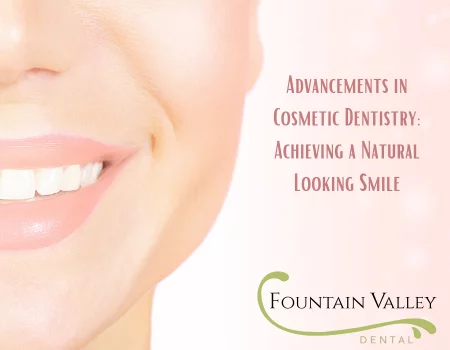 Advancements in Cosmetic Dentistry: Achieving a Natural-Looking Smile